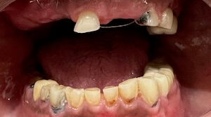 Before