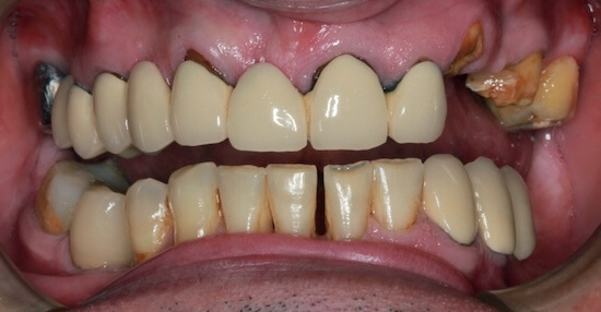 Lee Before
