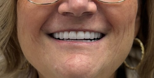 Terri G After