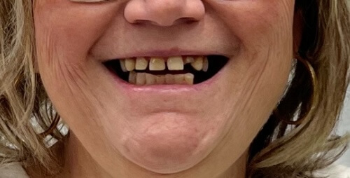 Terri G Before