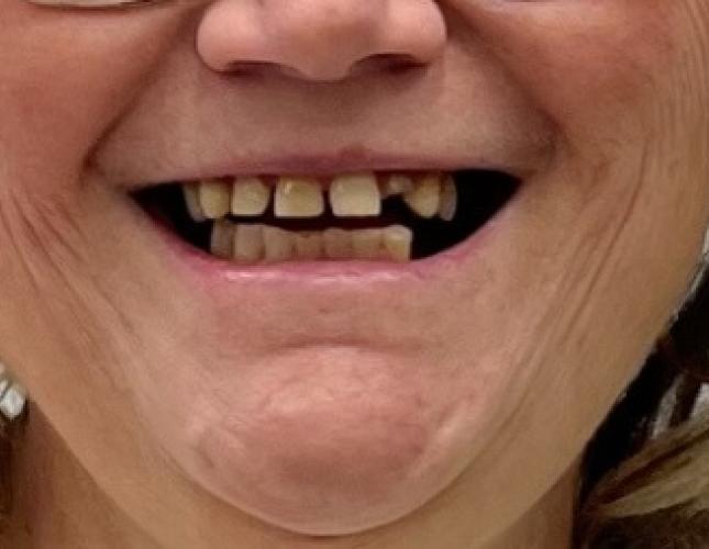 Terri G Before